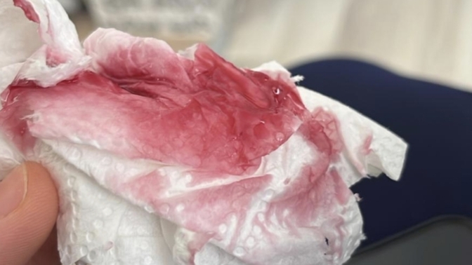 AĞIZDAN GELEN PEMBE RENKLİ PARFÜM KOKULU SIVI?