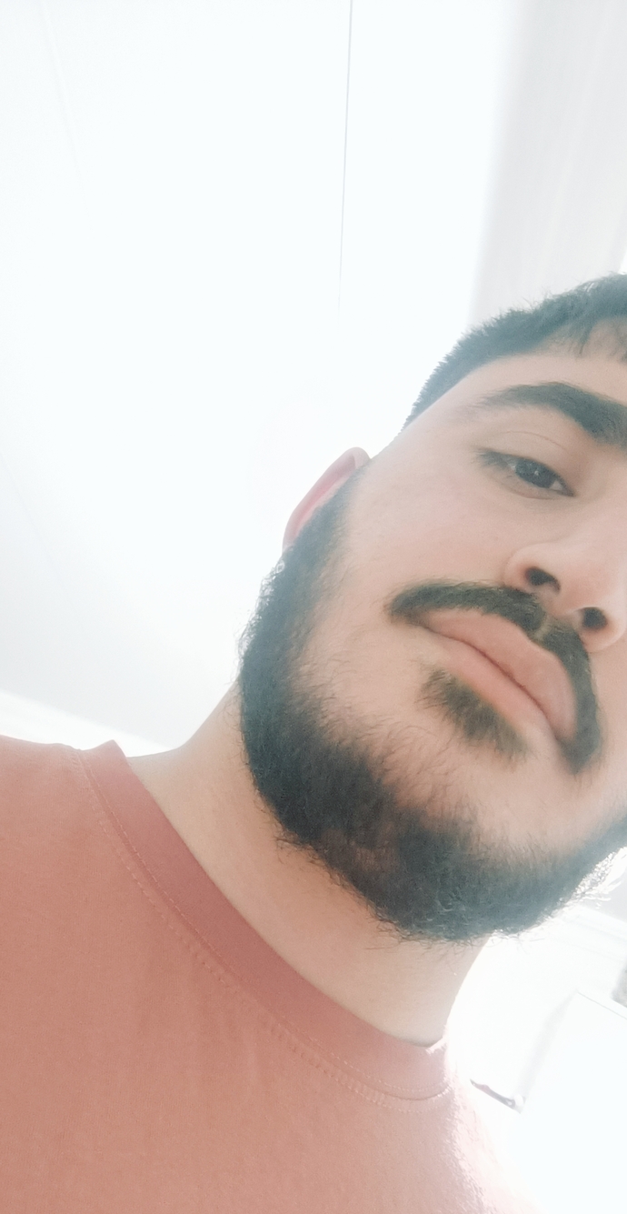 Eşiniz sakallarınız için lazere gitmenizi istese gider miydiniz?