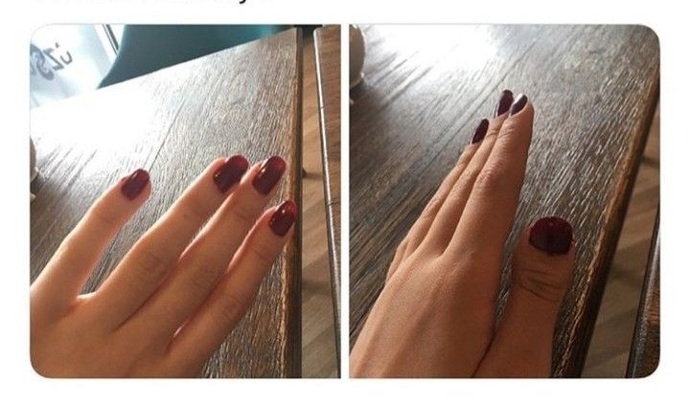 Sizinde baş parmaklarınız bu şekilde mi?