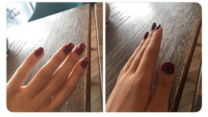 Sizinde baş parmaklarınız bu şekilde mi?