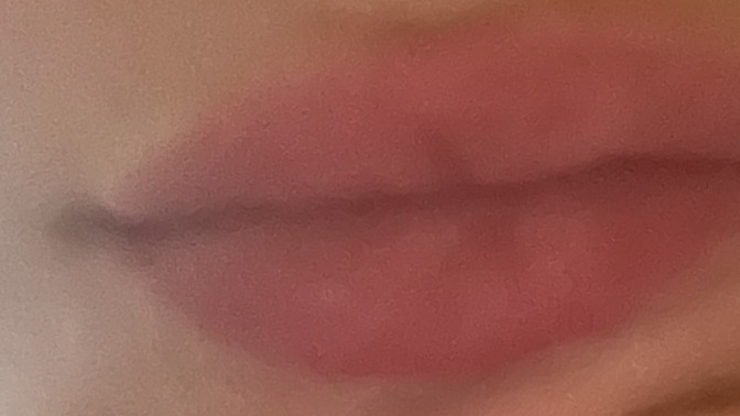 Dudağım dolgu mu sizce?