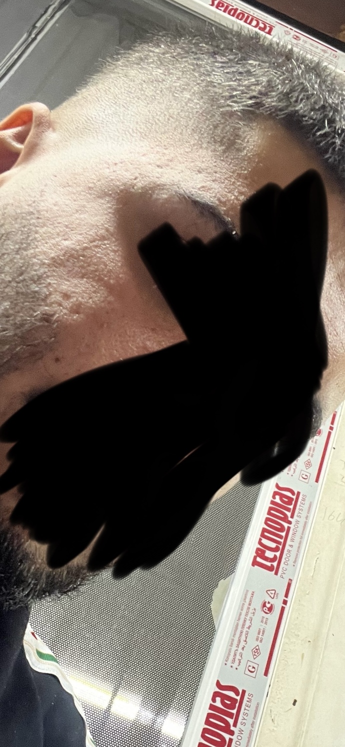 Cildim bu şekilde çok mu kötü çok kafaya takıyorum?