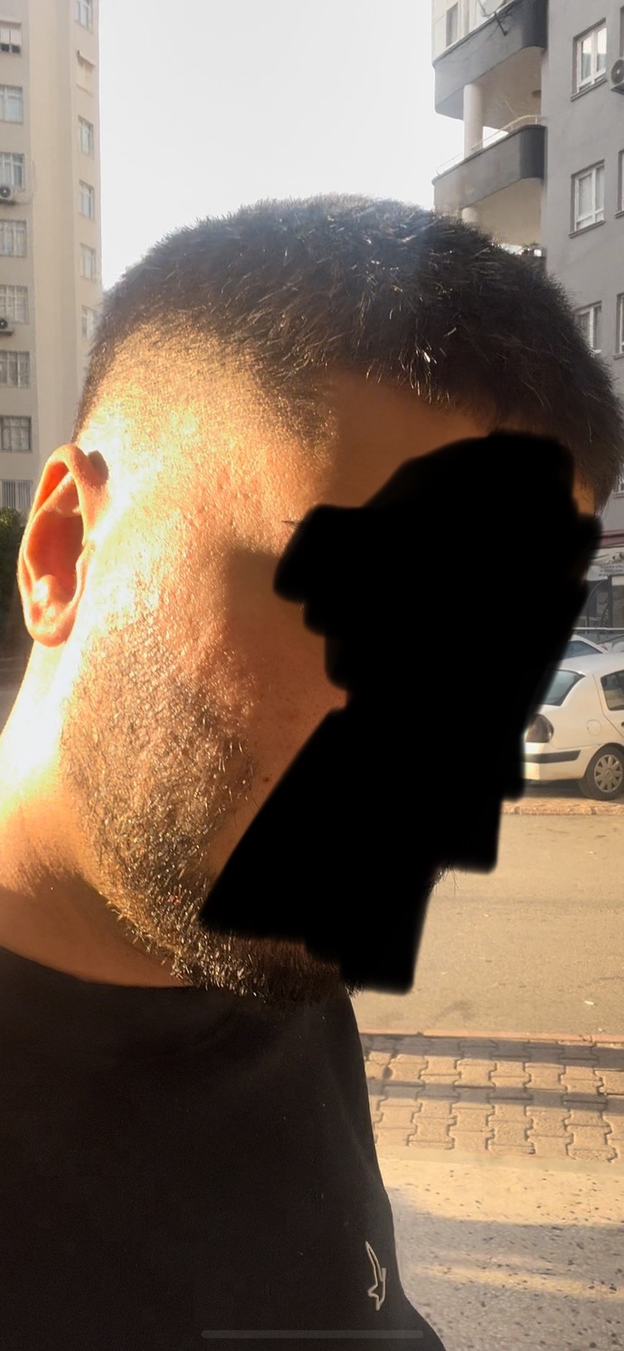 Cildim bu şekilde çok mu kötü çok kafaya takıyorum?