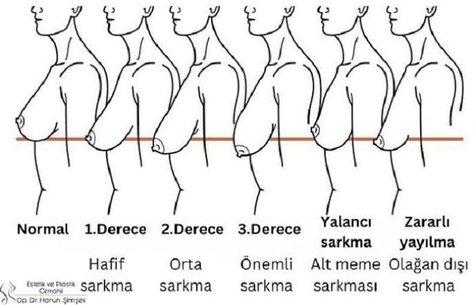 Bunlardan hangi durumda