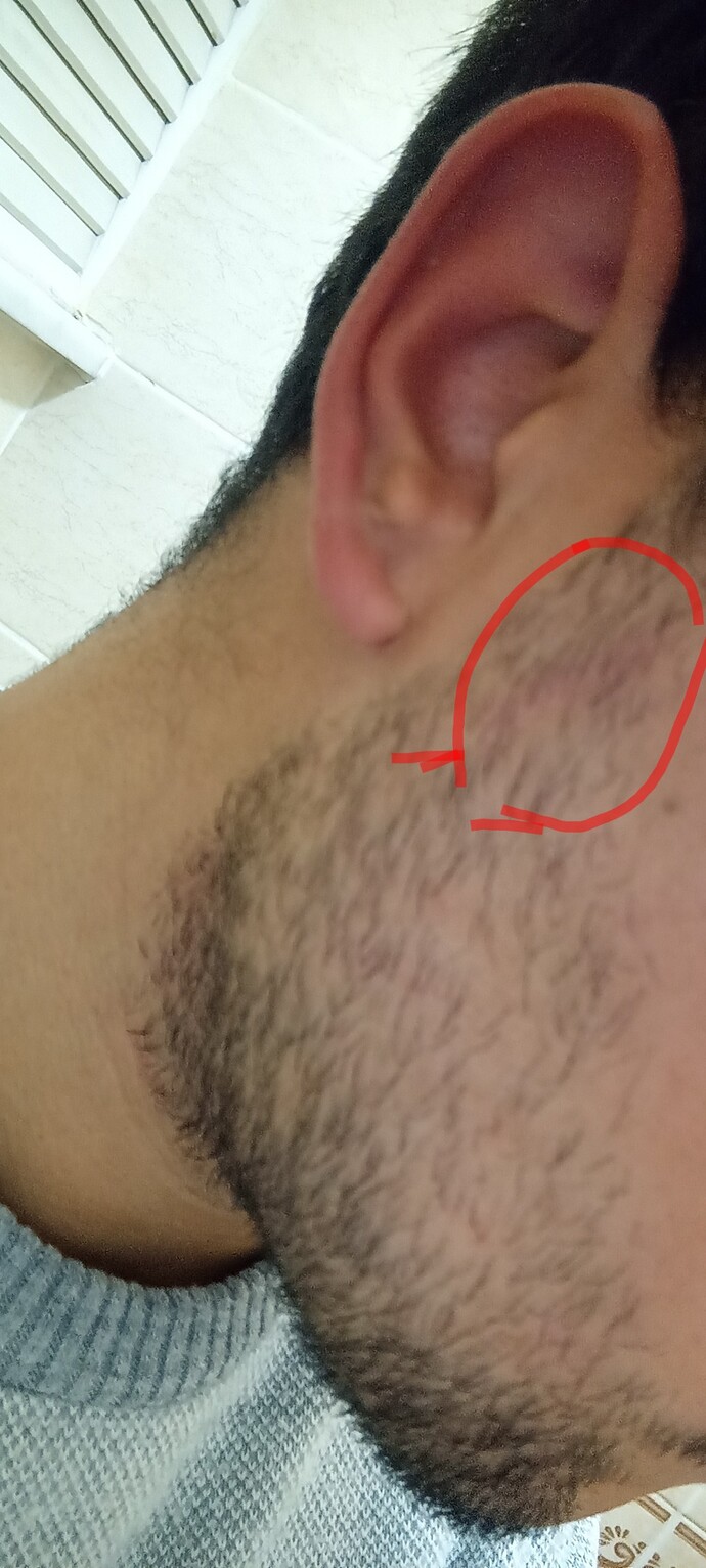 Jilet Kızarıklığı Polisliğe Engel Mi?