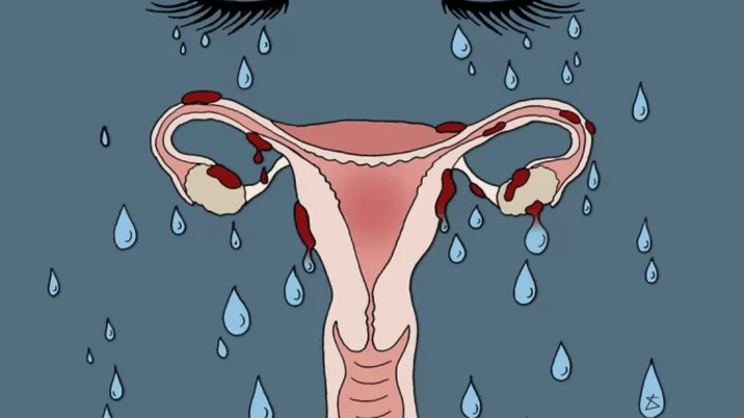 Regl depresyonu denen bir şey var mı?