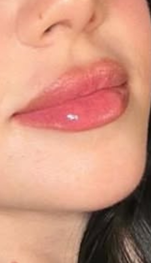 Bu dudaklardan hangisini tercih edersiniz?