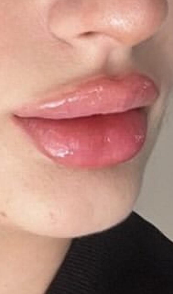 Bu dudaklardan hangisini tercih edersiniz?