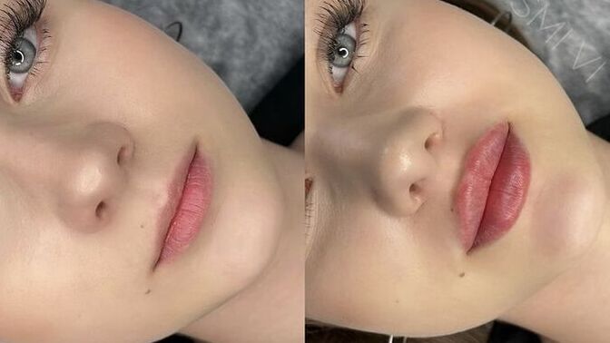 Dudak dolgunlaştırıcıya 700 tl verilir mi?