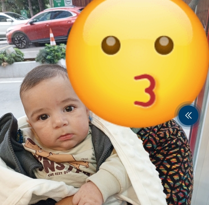Bakar mısınız bebeğimin göz altları neden böyle, tedavisi var mıdır?