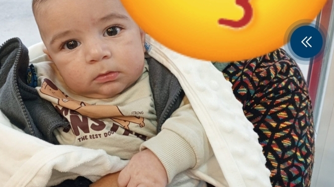 Bakar mısınız bebeğimin göz altları neden böyle, tedavisi var mıdır?