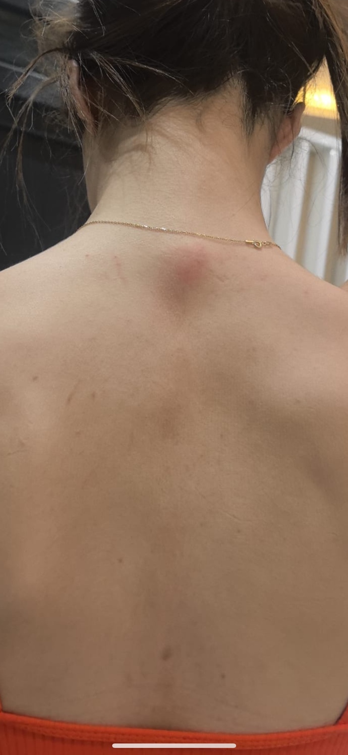 Sırtım durup dururken çok kaşınmaya başladı yüzümde öyle bunlar ne sizce?