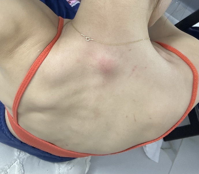 Sırtım durup dururken çok kaşınmaya başladı yüzümde öyle bunlar ne sizce?