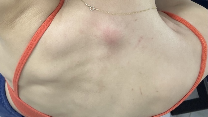 Sırtım durup dururken çok kaşınmaya başladı yüzümde öyle bunlar ne sizce?