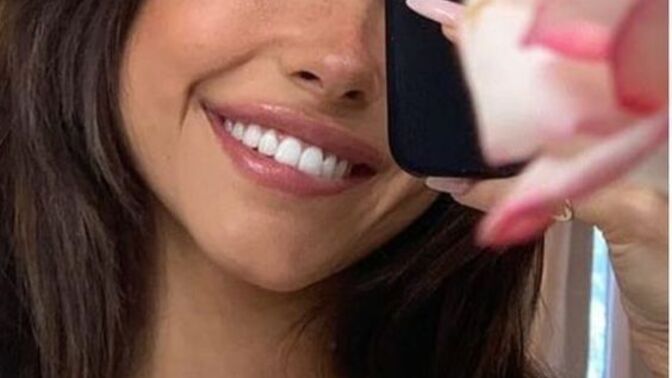 Düzenli diş fırçalamak dişleri beyazlatır mı?