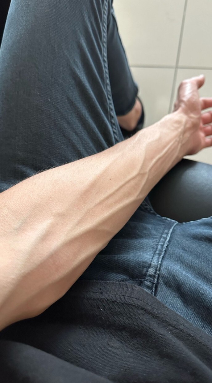 Erkekte böyle damarlı kollar güzel çekici mi sizce?