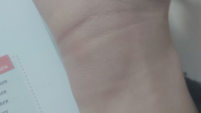 Bileğim çok şişti kaşınıyor ne yapabilirim?