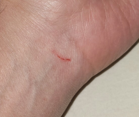 Kedi tırmaladı? Kuduz aşısına gerek var mıdır?