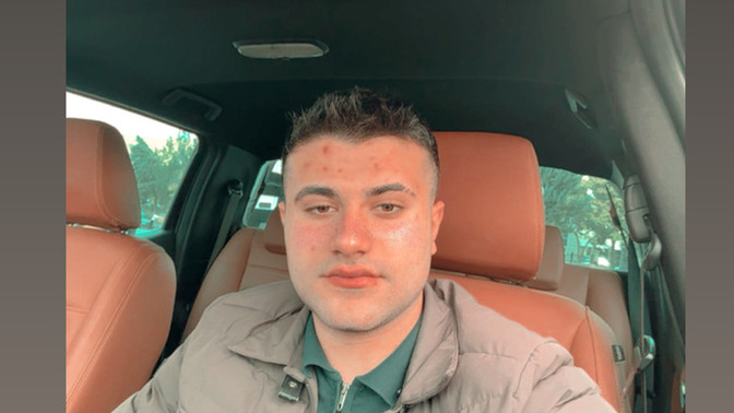 19 yaş depresyonda heba edip 25 gözükmek?