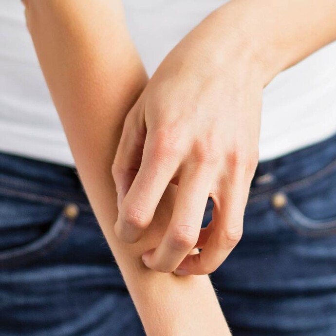 Güneşli havada oturunca vücudumda iğne batması gibi kaşıntı başladı, sizde de oluyor mu?