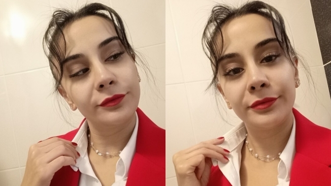 Normalde yaptıranlar bana ördek gibi geliyor ama dudak dolgusu yaptırmalı mıyım?