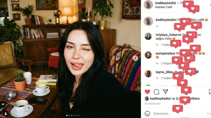 Burun estetiği, dudak dolgusu...💋 Herkes çok sıradan olmaya başlamadı mı sizce?