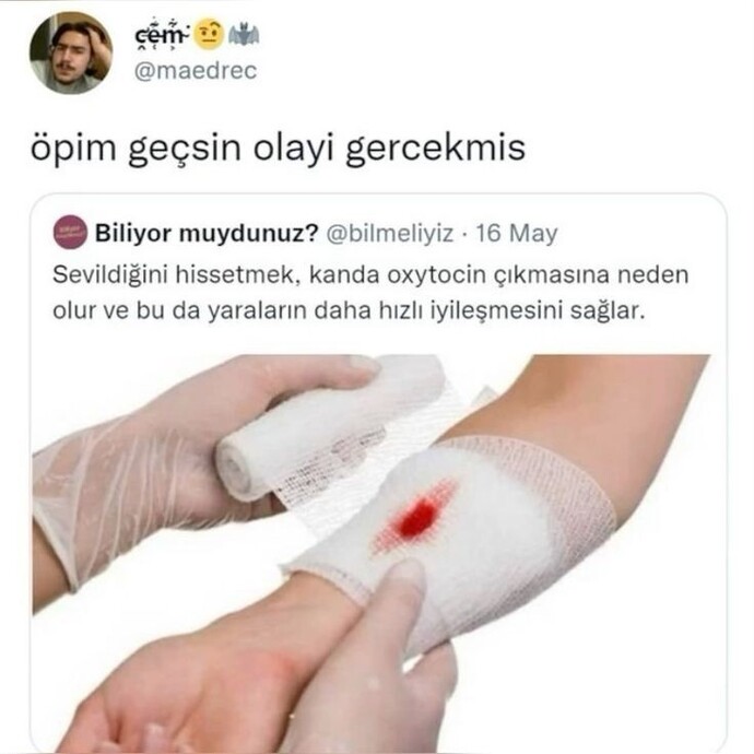 Hiç birisine hadi öpeyim de geçsin dediniz mi?