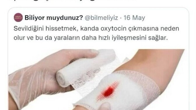 Hiç birisine "hadi öpeyim de geçsin" dediniz mi?