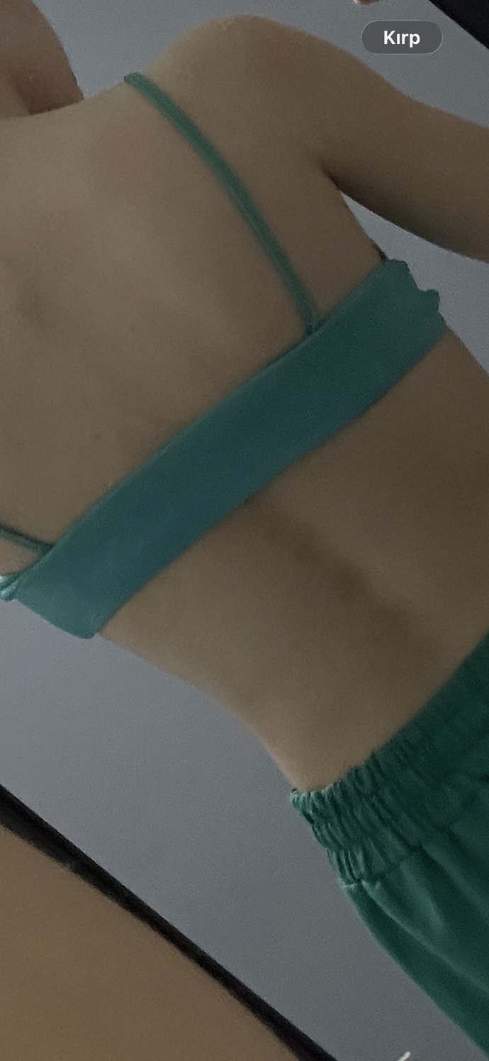 Sırtımda çok mu leke var?
