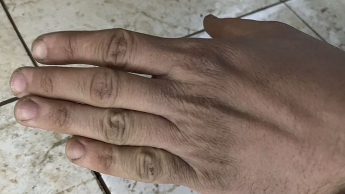 Ellerim için hangi kremi önerirsiniz?