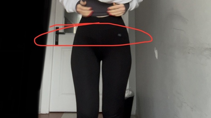 Ya leğen kemiklerim doğuştan geniş, o yüzden zayıflasam da geniş duruyor. Çok mu geniş sizce🫠 ?