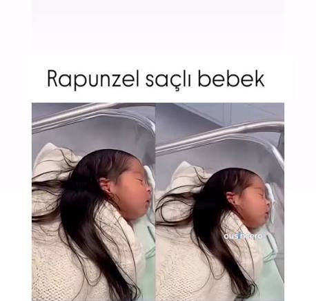 Hiç uzun saçlı yeni doğan bebek gördünüz mü?