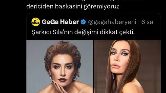 Estetik kötü değil mi ya?