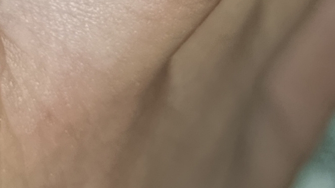 Bu nedir ayağımda çıkmış parmakta?