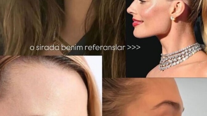 Burun ameliyatında yeni moda "burna kemik ekletmek" oldu. Ne düşünüyorsun?