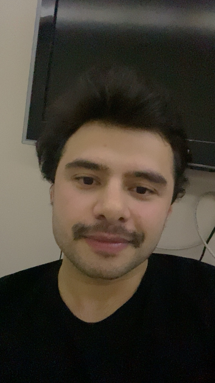 Fotoğraf biraz kalitesiz