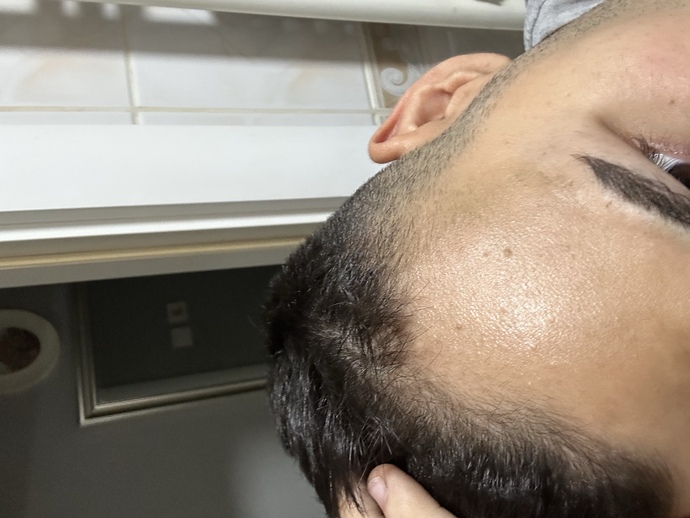 Saçlar gitmiş durumda ön kısmı üst arka vs bi sıkıntı yok bi tek üst bu kısma ekme işlemi yapılıyor mu?