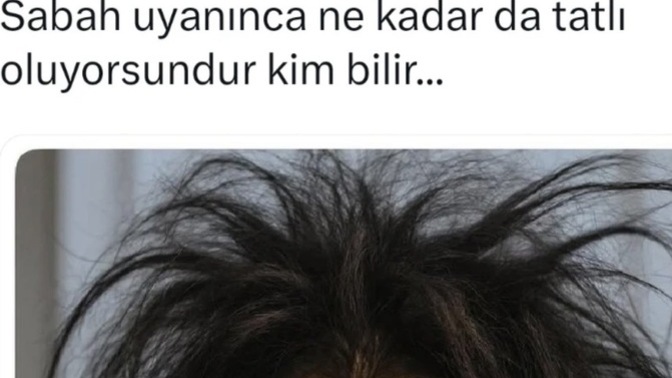 Sabahları uyanınca böyle tatlı mı oluyorsunuz?