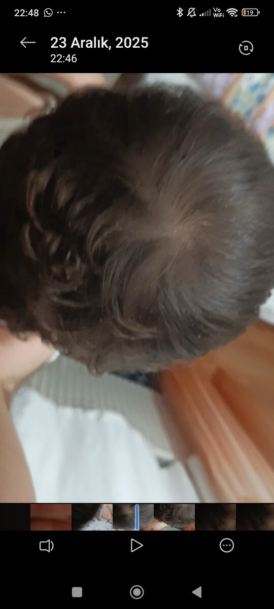 Kafa tepemde açılmamı var?