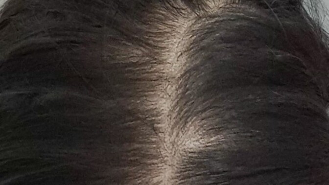 Az önce sormuştum. Sizce saç diplerim cok mu vahim durumda?