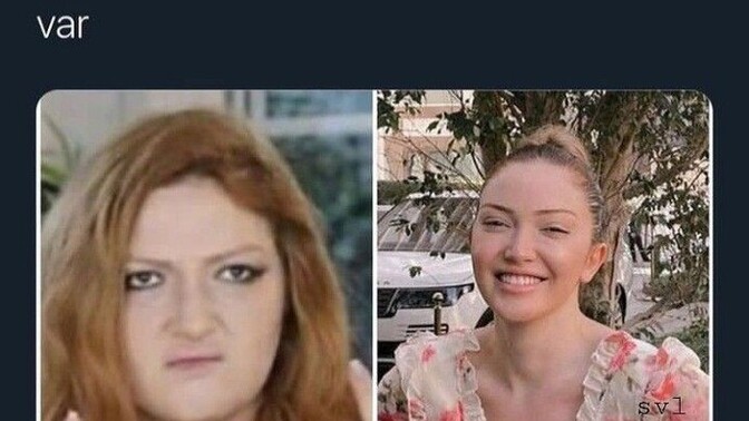 Estetiğe ihtiyacınız var mı?