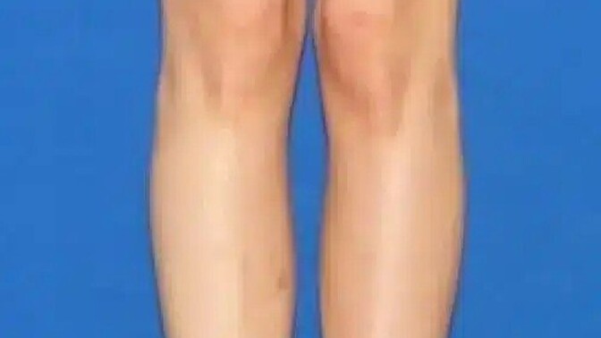 Çarpık ve ince bacaklı kızlar çok itici değil mi?