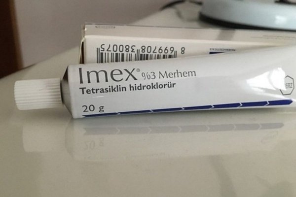 Imex kullananlar, Imex işe yarıyor mu?