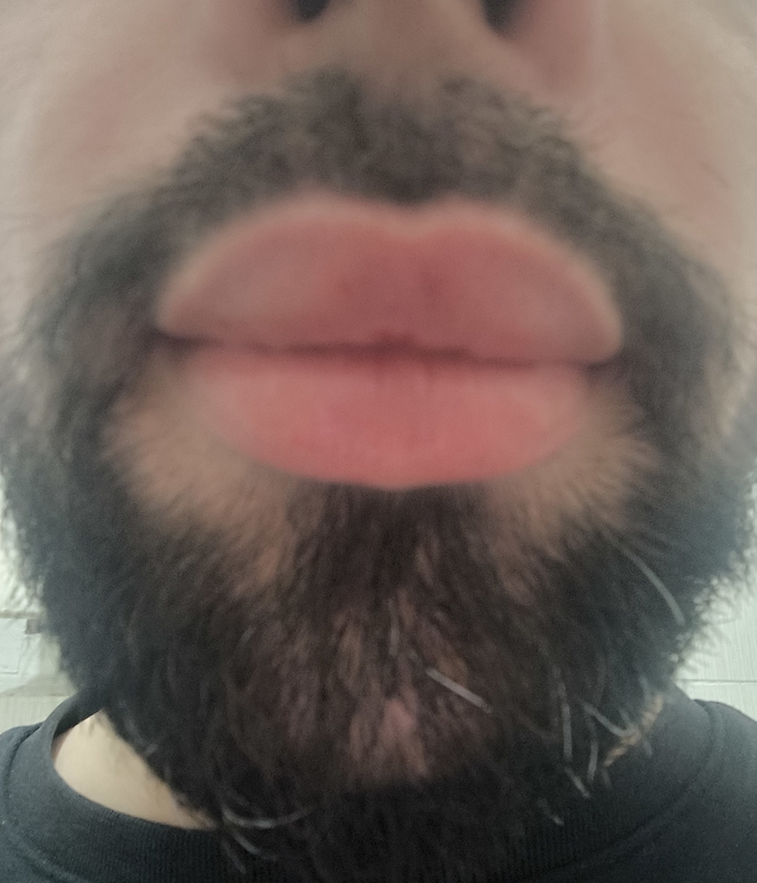 Kalın dudaklı erkek çekici mi geliyor, kadınlar için gerçekten bir artı mı 😅?