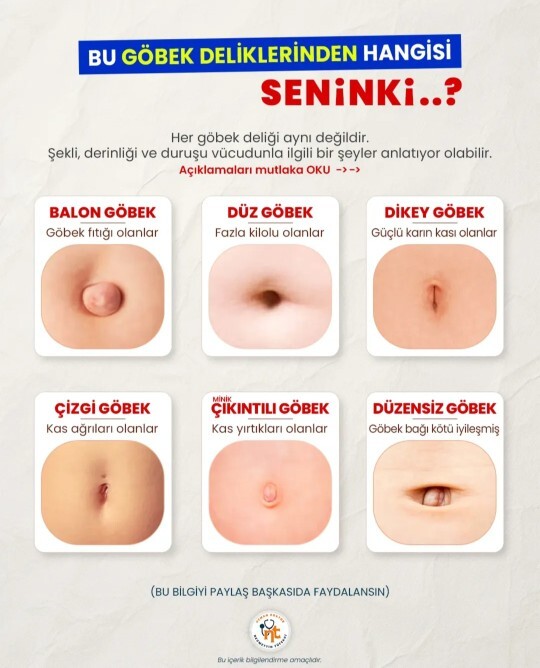 Sizinkisi hangisi?