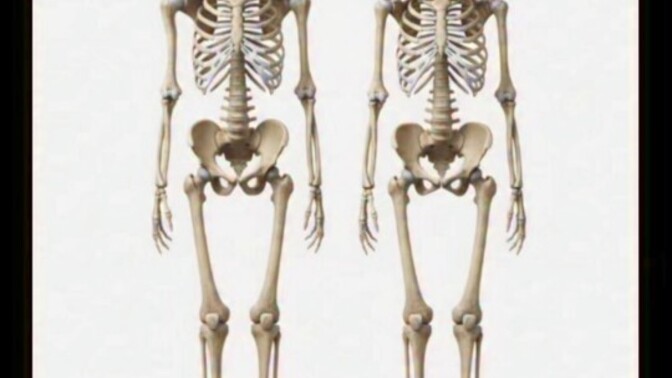 Bu iskeletlerden hangisi kadın hangisi erkek?