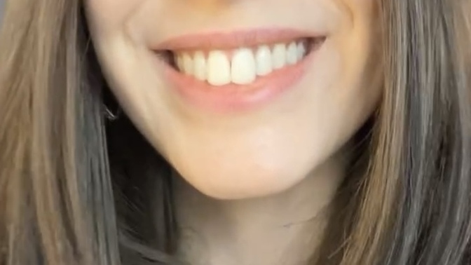 Erkekler, bu şekilde görünen dişler sizce çekici mi yoksa kötü mü?