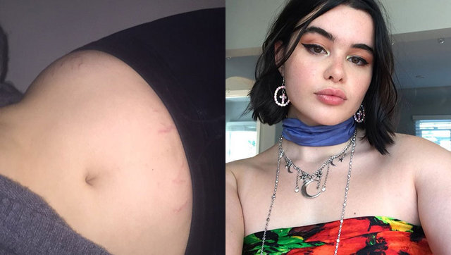 Bazı vücut kusurları seksi olmaya engel mi sizce?