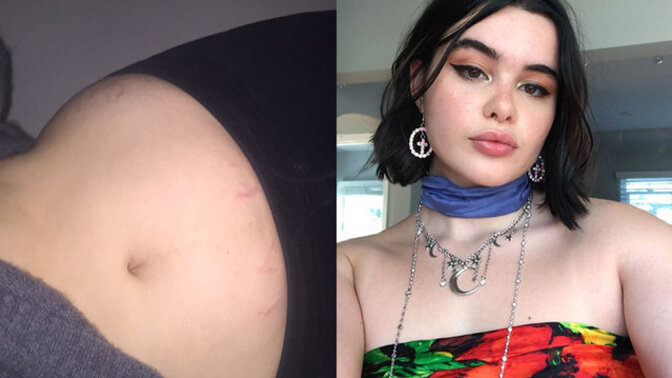 Bazı vücut kusurları seksi olmaya engel mi sizce?