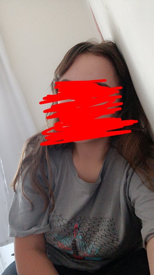 Geniş alını normalleştirsek olur mu ektirme çok pahslı da?